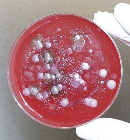 OMInBacteriaCulture.jpg